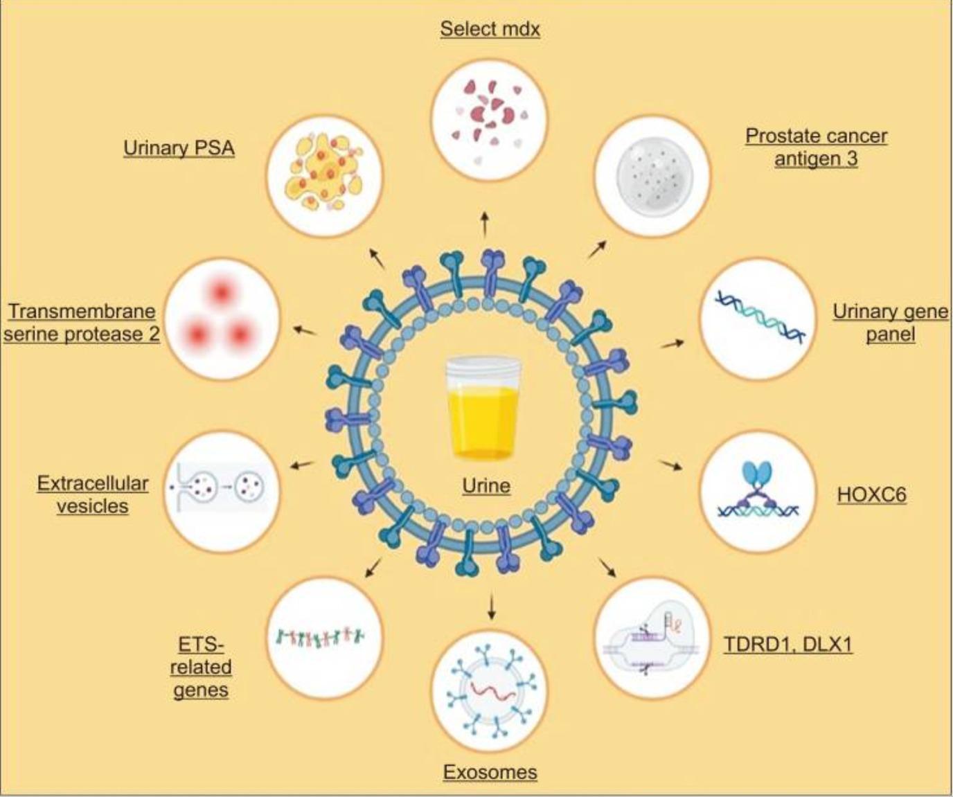 A diagram of a urinary tract

AI-generated content may be incorrect.